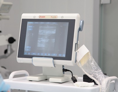 Ультразвуковой сканер последнего поколения, на котором доктор проводит УЗИ вен в Москве